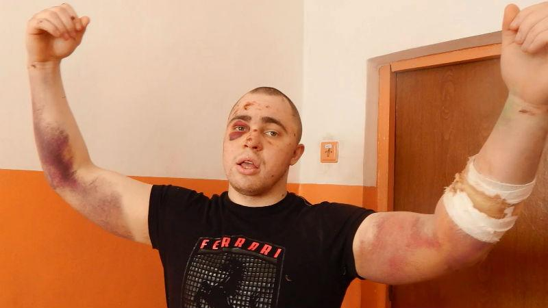 Бывшие узники рассказали о страшных издевательствах в бердянской колонии