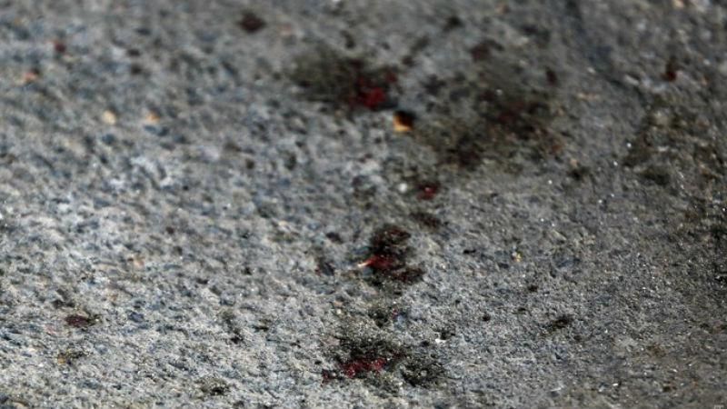 З'явилося страшне відео з місця різанини в Одесі (18+) З'явилося страшне відео з місця різанини в Одесі (18+)