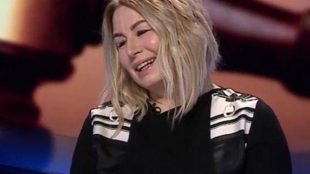 Хірург розказав деталі славнозвісної пластики Герман Хірург розказав деталі славнозвісної пластики Герман