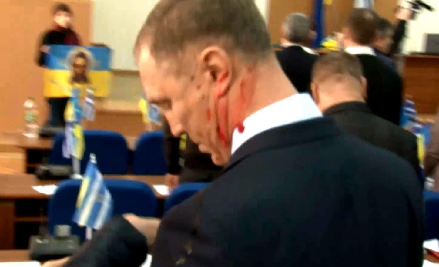 У херсонській мерії "кров’ю" проганяли одіозного депутата У херсонській мерії "кров’ю" проганяли одіозного депутата