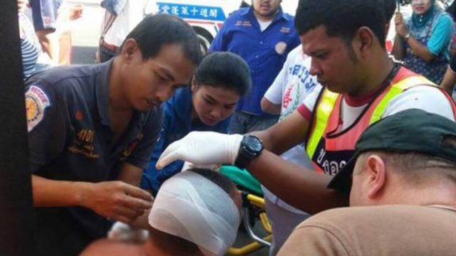 Российскому туристу в Таиланде отрезали ухо на рынке