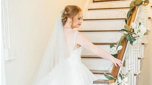 Модель із синдромом Дауна знялася у чуттєвій фотосесії Модель із синдромом Дауна знялася у чуттєвій фотосесії