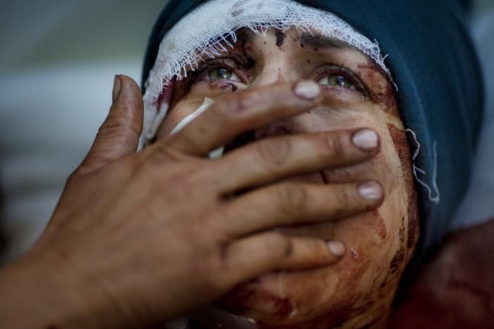 Жертвы русской авиации: сколько погибло мирных жителей в Сирии