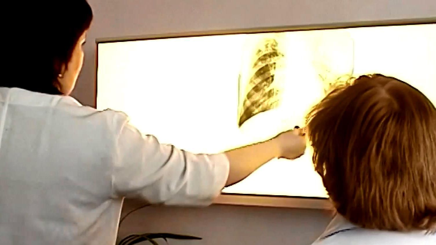 Отличается ли официальное и реальное число больных туберкулезом Отличается ли официальное и реальное число больных туберкулезом