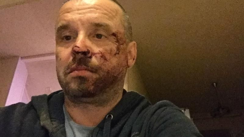 Побили, знаючи, хто я такий, — політик заявив про напад поліції Побили, знаючи, хто я такий, — політик заявив про напад поліції