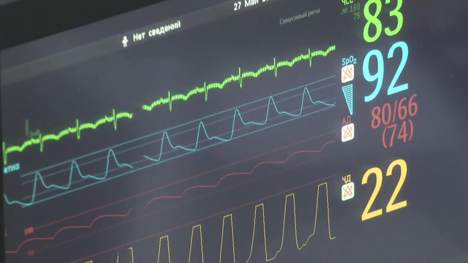 Киевские кардиологи получили от благотворителей оборудование для спасения детей Киевские кардиологи получили от благотворителей оборудование для спасения детей