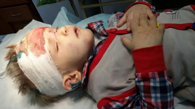 Искалеченного мальчика, который ничего не помнит, нашли в Одессе Искалеченного мальчика, который ничего не помнит, нашли в Одессе