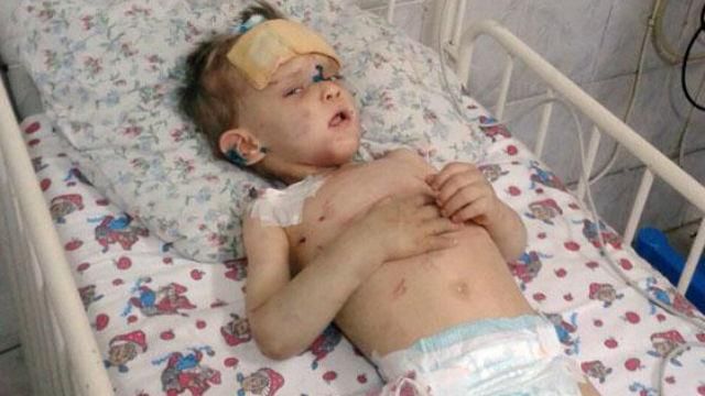 Хороша новина. У побитого в Одесі хлопчика знайшлася рідня Хороша новина. У побитого в Одесі хлопчика знайшлася рідня