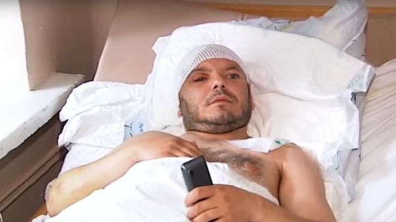 У нічному кафе по-звірячому побили бійця АТО У нічному кафе по-звірячому побили бійця АТО