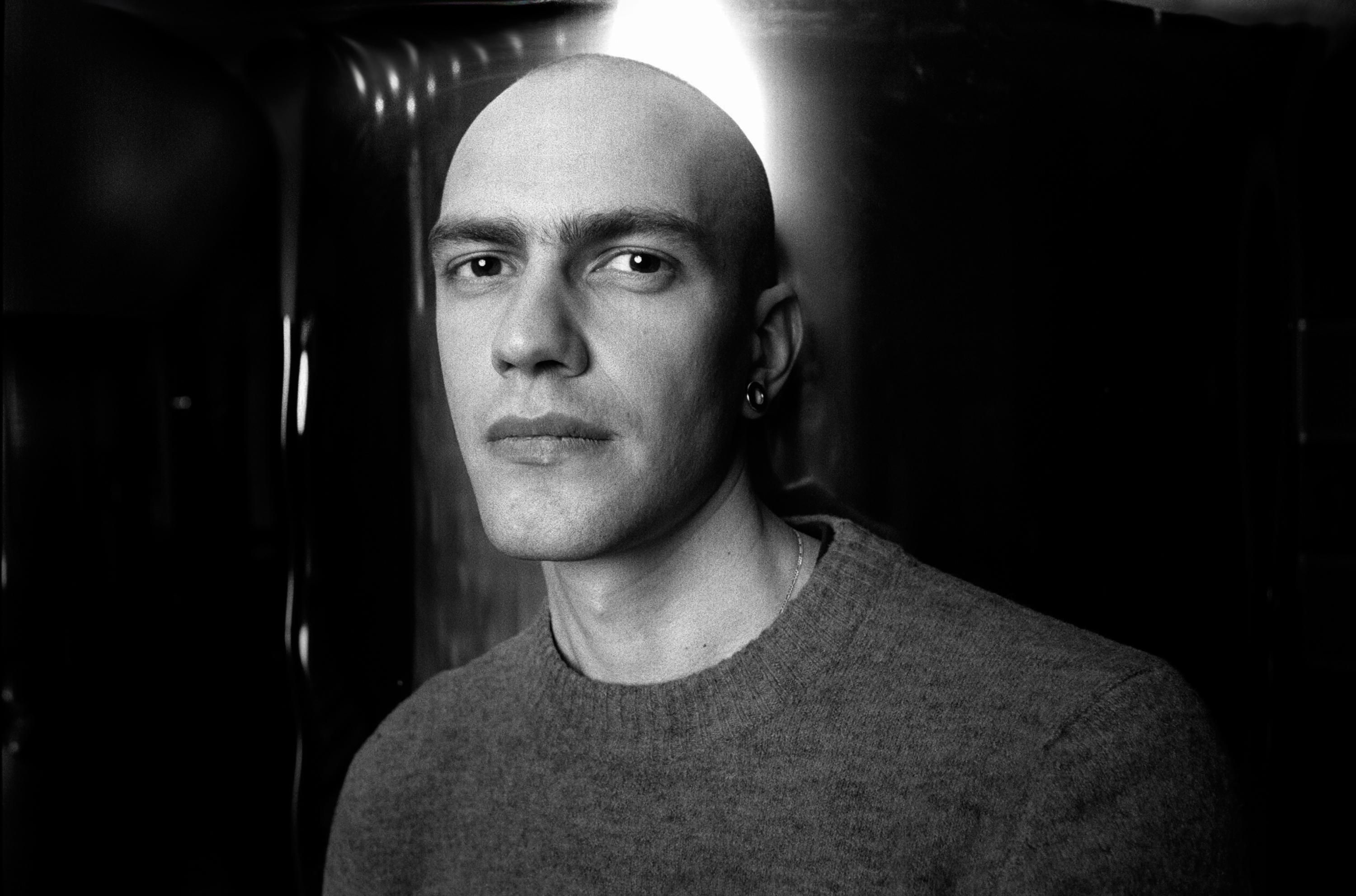 Жорстоко побитий волонтер Моргунов прийшов до тями Жорстоко побитий волонтер Моргунов прийшов до тями