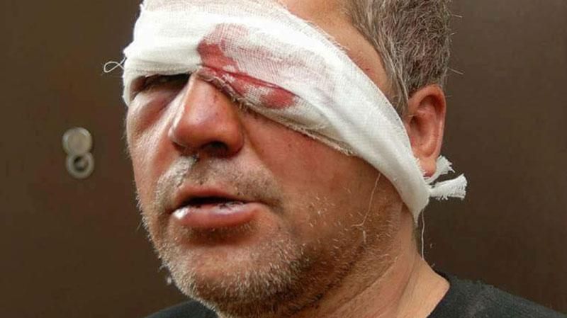 Героя АТО до полусмерти избили в Запорожье Героя АТО до полусмерти избили в Запорожье