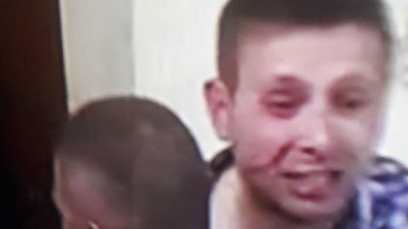 ТОП-новини: Парасюку розбили ніс, шокуючі втрати на Донбасі ТОП-новини: Парасюку розбили ніс, шокуючі втрати на Донбасі