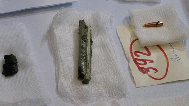 Выставка осколков, извлеченных из бойцов АТО, открылась в Днепре (18+) Выставка осколков, извлеченных из бойцов АТО, открылась в Днепре (18+)