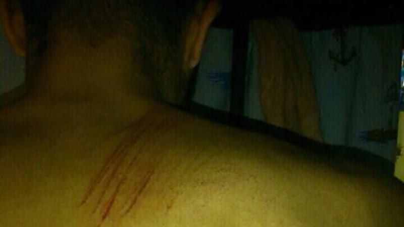 З'явилися фото торнадівців після побиття З'явилися фото торнадівців після побиття