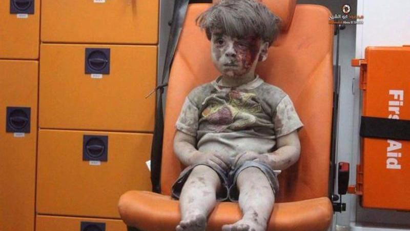 В Сирии умер брат мальчика, фото которого шокировали мир