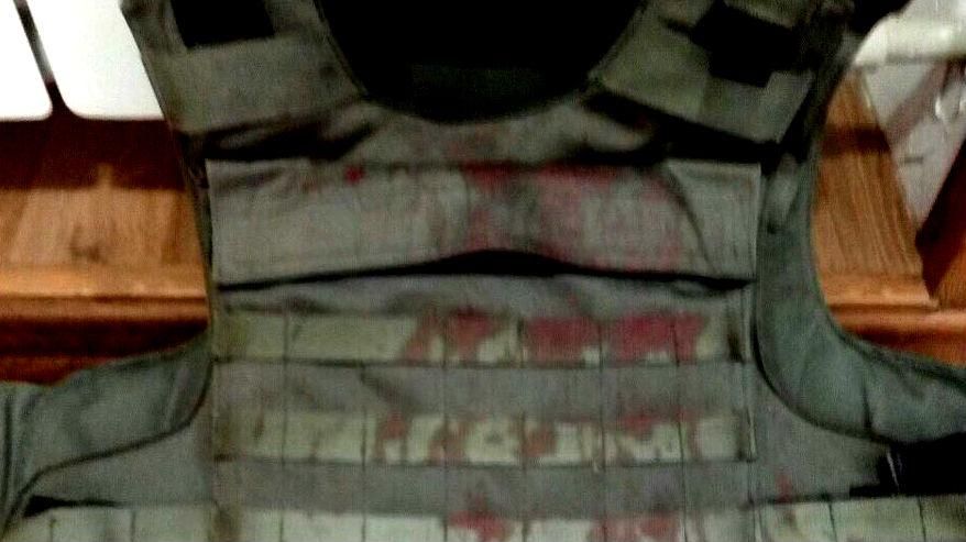 Стрельба на оборонном предприятии: появились фото раненого нацгвардейца Стрельба на оборонном предприятии: появились фото раненого нацгвардейца