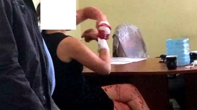 Росіянка влаштувала криваві розбірки у львівському РАЦСі Росіянка влаштувала криваві розбірки у львівському РАЦСі