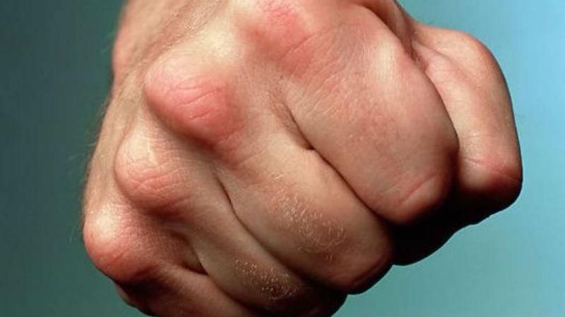 Депутатов серьезно избили в Винницкой области Депутатов серьезно избили в Винницкой области