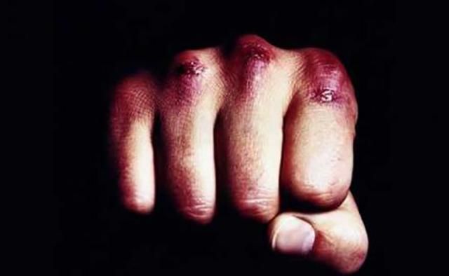 Водій до смерті побив чоловіка, який зробив йому зауваження Водій до смерті побив чоловіка, який зробив йому зауваження