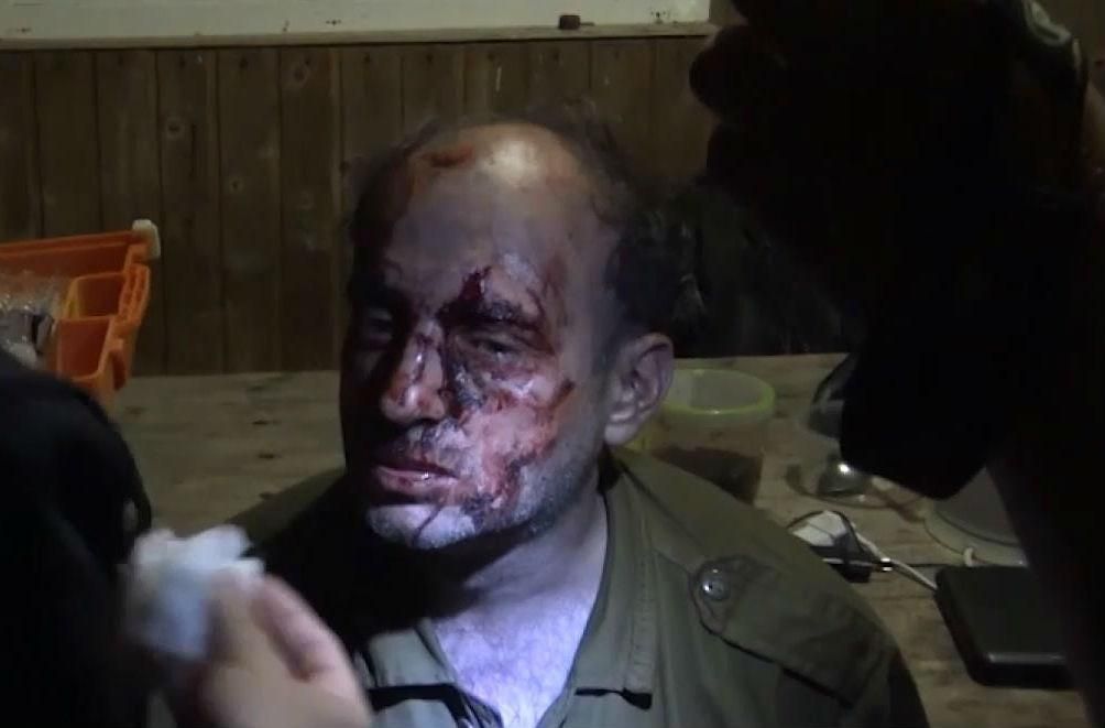 В России жестоко избили активистов Greenpeace В России жестоко избили активистов Greenpeace