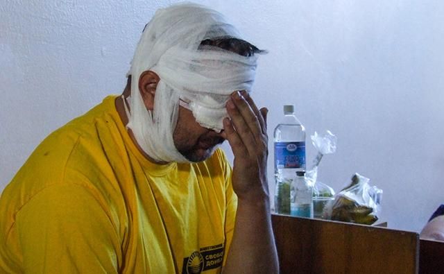 Під Донецьком поранили відомого російського пропагандиста, – ЗМІ Під Донецьком поранили відомого російського пропагандиста, – ЗМІ