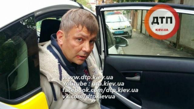 Порушник сильно вдарив поліцейського у Києві