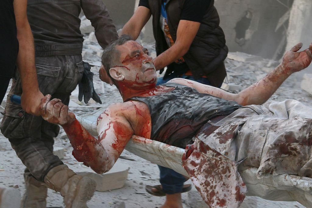 З'явились фото наслідків кривавого обстрілу Алеппо (18+)