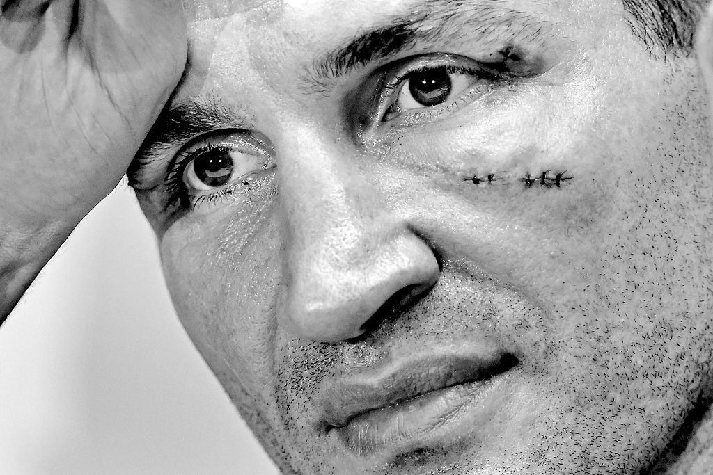 Реванш Кличко-Ф’юрі скасовано, румунський землетрус відчули в Україні – найцікавіше за день Реванш Кличко-Ф’юрі скасовано, румунський землетрус відчули в Україні – найцікавіше за день