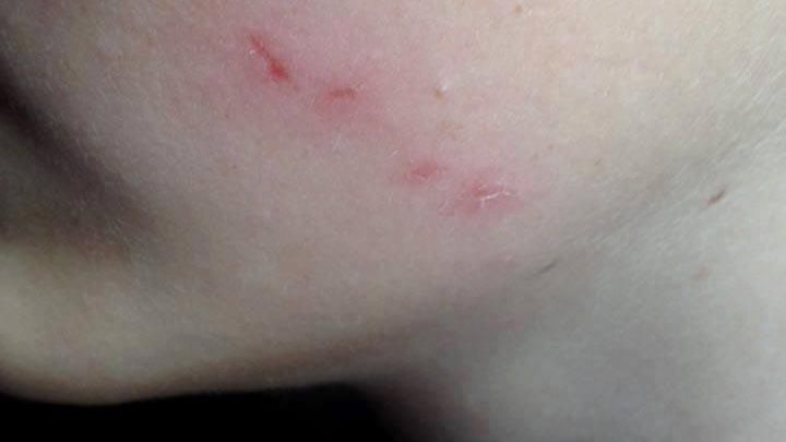 Вчителька роздряпала обличчя школяра у Дніпрі Вчителька роздряпала обличчя школяра у Дніпрі