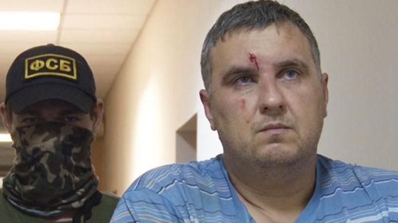 Кримські окупанти жахливо катували українця, якого звинуватили у диверсії 