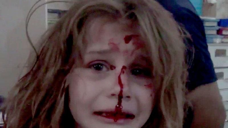 Відео, що вразило світ: закривавлена дівчинка кличе тата після бомбардування Сирії