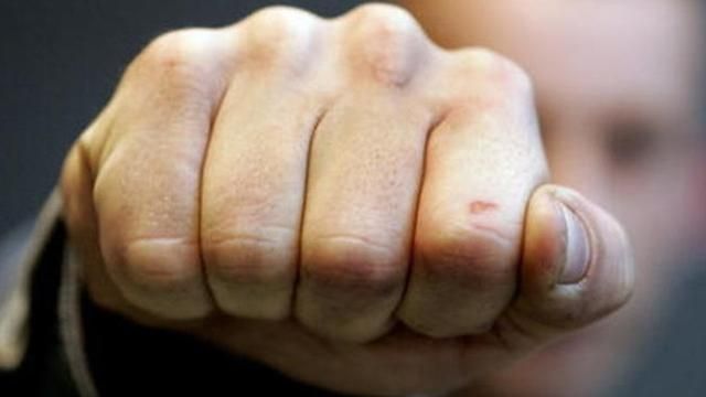 Учасник АТО постраждав під час бійки, яка сталася через російський канал Учасник АТО постраждав під час бійки, яка сталася через російський канал