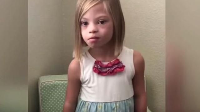 Маленькая украинка с синдромом Дауна растрогала сеть Маленькая украинка с синдромом Дауна растрогала сеть