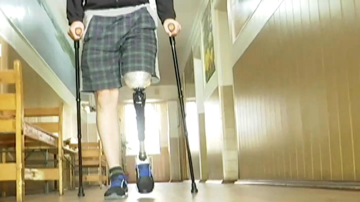 Винницкие инженеры разработали высокотехнологичный протез Винницкие инженеры разработали высокотехнологичный протез