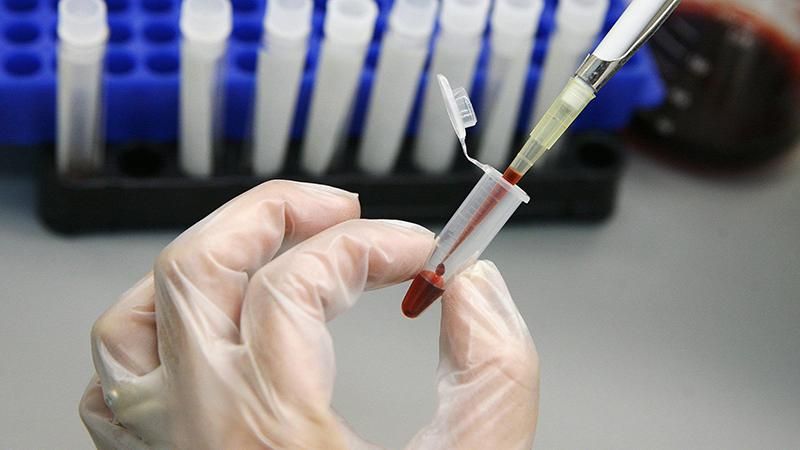 Вчені зробили сенсаційний крок у лікуванні СНІДу Вчені зробили сенсаційний крок у лікуванні СНІДу