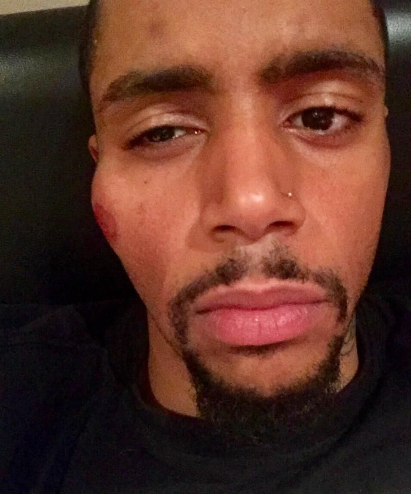 Боксеру довелось відмовитись від бою через удар цеглиною по обличчю
Боксеру довелось відмовитись від бою через удар цеглиною по обличчю