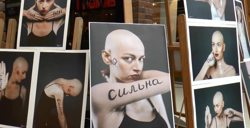 Активістка влаштувала фотовиставку на підтримку онкохворих в Сумах
