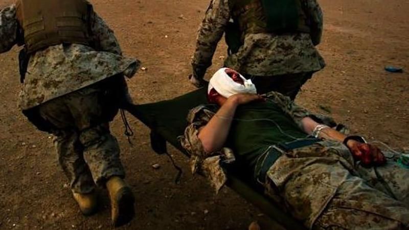 Українські воїни постраждали внаслідок обстрілу терористів на Луганщині