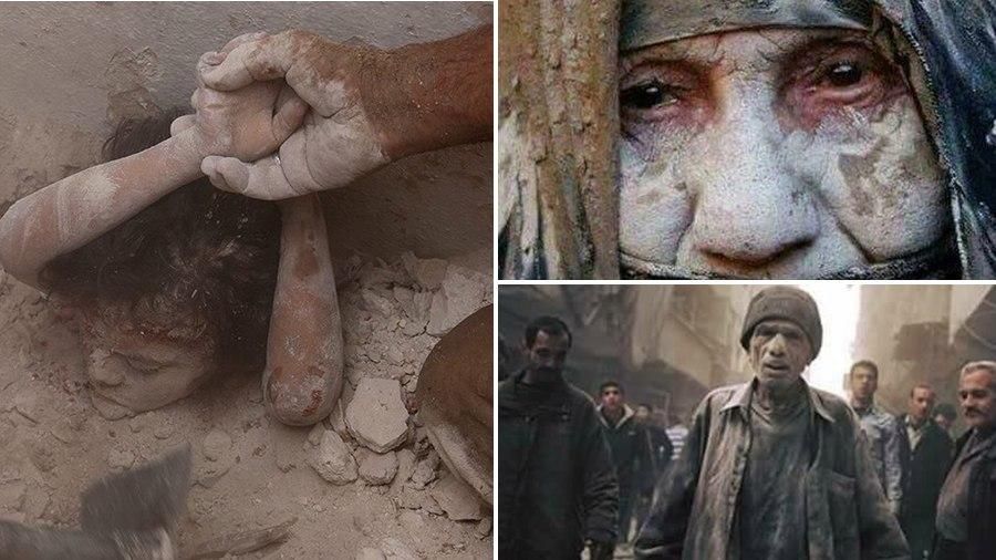 Чуркин жестоко прокомментировал жуткие фото детей в Сирии Чуркин жестоко прокомментировал жуткие фото детей в Сирии