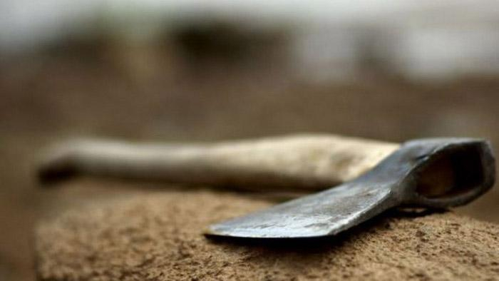 Патрульного, который получил топором по голове, спасли в Днепре