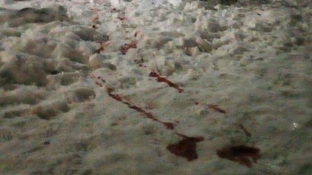 В больнице скончался еще один участник стрельбы в Олевске В больнице скончался еще один участник стрельбы в Олевске