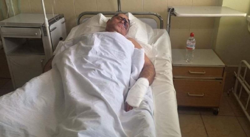 В Одессе жестоко избили представителя "Оппозиционного блока" В Одессе жестоко избили представителя "Оппозиционного блока"