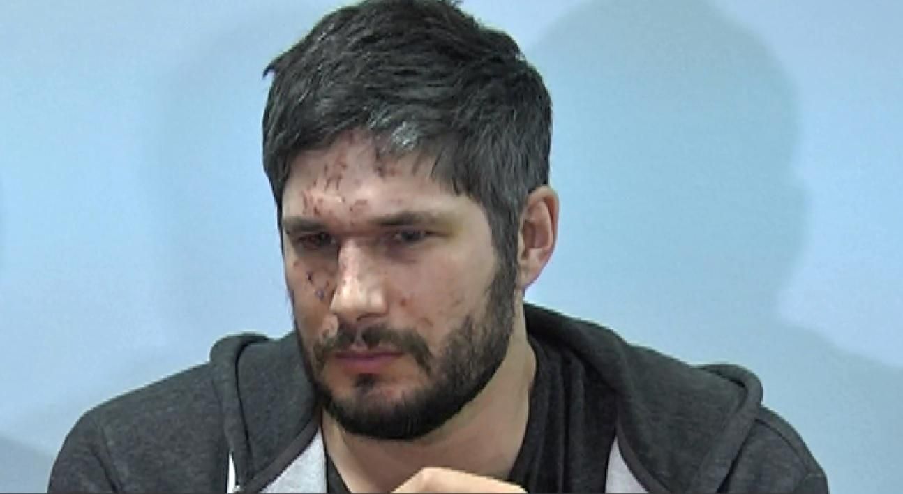 У Дніпрі оперуватимуть британського фотокора, пораненого в Авдіївці У Дніпрі оперуватимуть британського фотокора, пораненого в Авдіївці