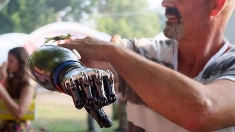 Фонд соцзахисту інвалідів займатиметься протезами для бійців АТО   