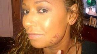 Скандальный развод: экс-участница Spice Girls рассказала об издевательствах мужа