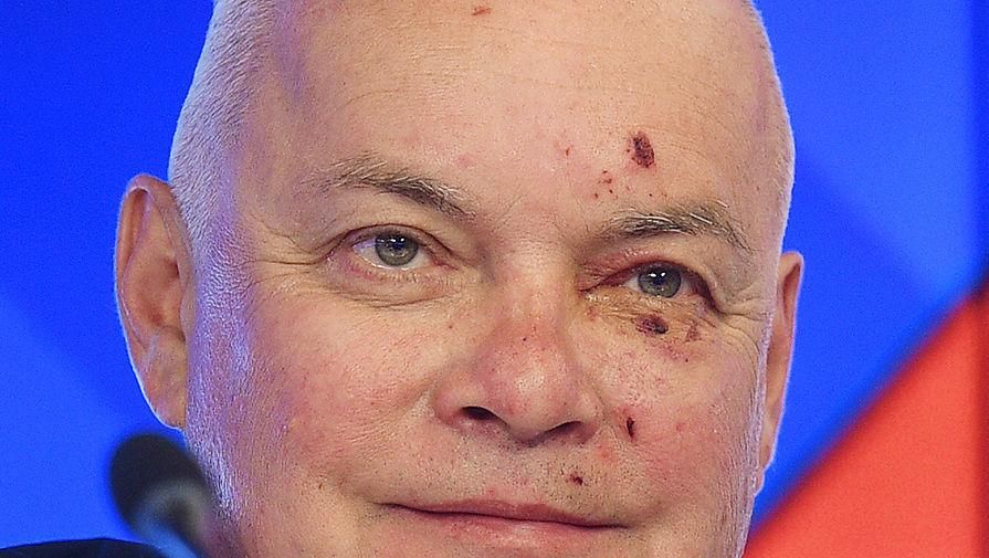 Пропагандист Кисельов вийшов на публіку з побитим обличчям: фото Пропагандист Кисельов вийшов на публіку з побитим обличчям: фото