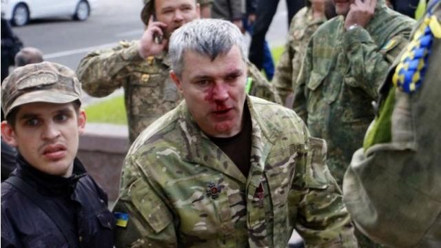 Волонтери показали, як зараз виглядають ветерани АТО, яких побили "тітушки" у Дніпрі Волонтери показали, як зараз виглядають ветерани АТО, яких побили "тітушки" у Дніпрі