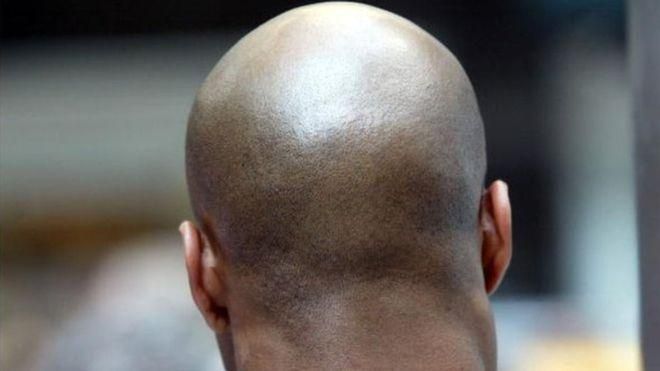 В Мозамбике ритуально убили лысых мужчин В Мозамбике ритуально убили лысых мужчин