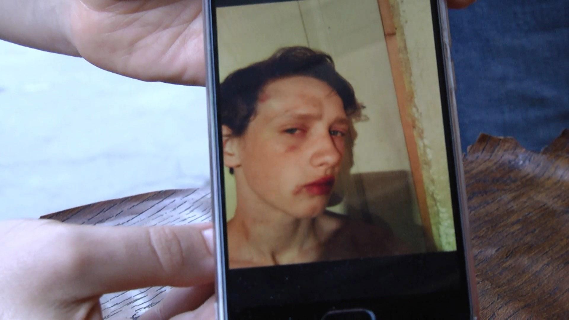 На Харківщині підлітка побив гумовим кийком наглядач в'язниці