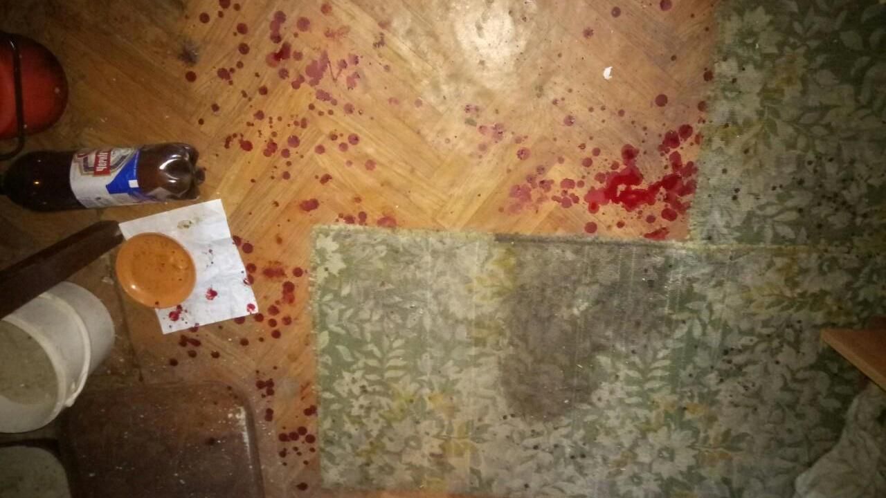 Участник АТО серьезно пострадал в результате взрыва на Харьковщине Участник АТО серьезно пострадал в результате взрыва на Харьковщине